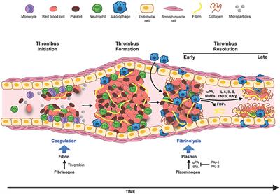 Fibrinolysis and Inflammation in Venous Thrombus Resolution